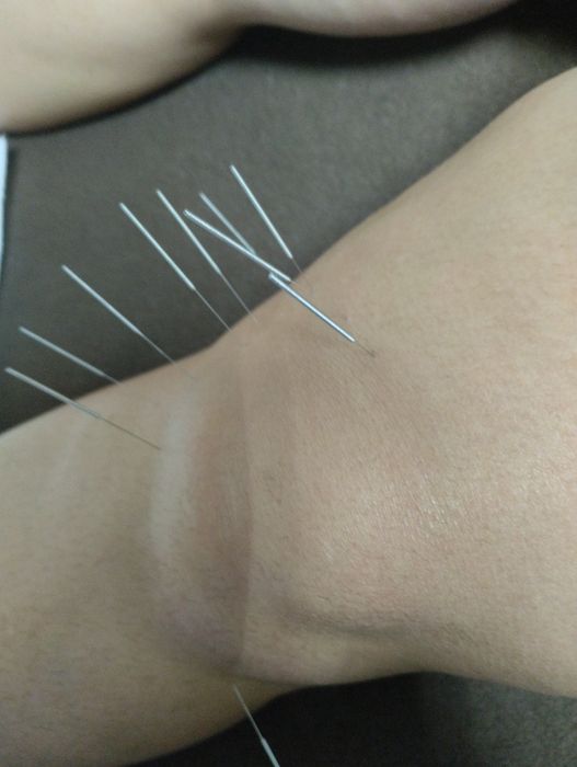 Послуги масажу  . Всі види оздоровчого масажу