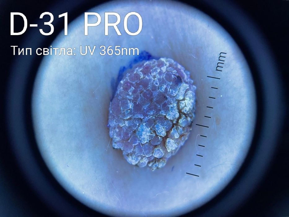 Дерматоскопи INVITA зі збільшенням в 6 та 10 разів