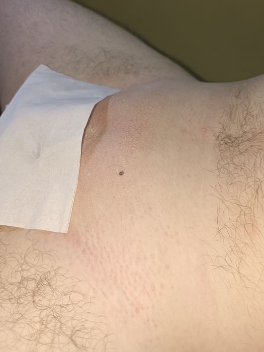 Чоловіча депіляція, видалення волосся для чоловіків на тілі та обличчі