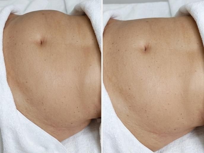 Ritual da Beleza em Benfica