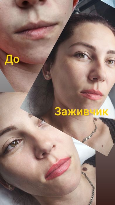 Перманентный макияж. Лазерное удаление татуажа, тату