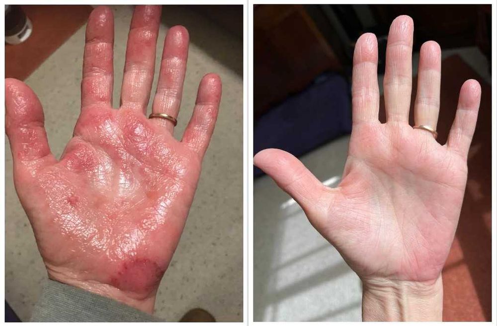 Suplemento de curcumina, anti-inflamatório natural, 95% maior absorção