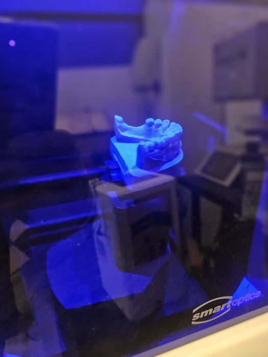 Scanner dentario smartoptics