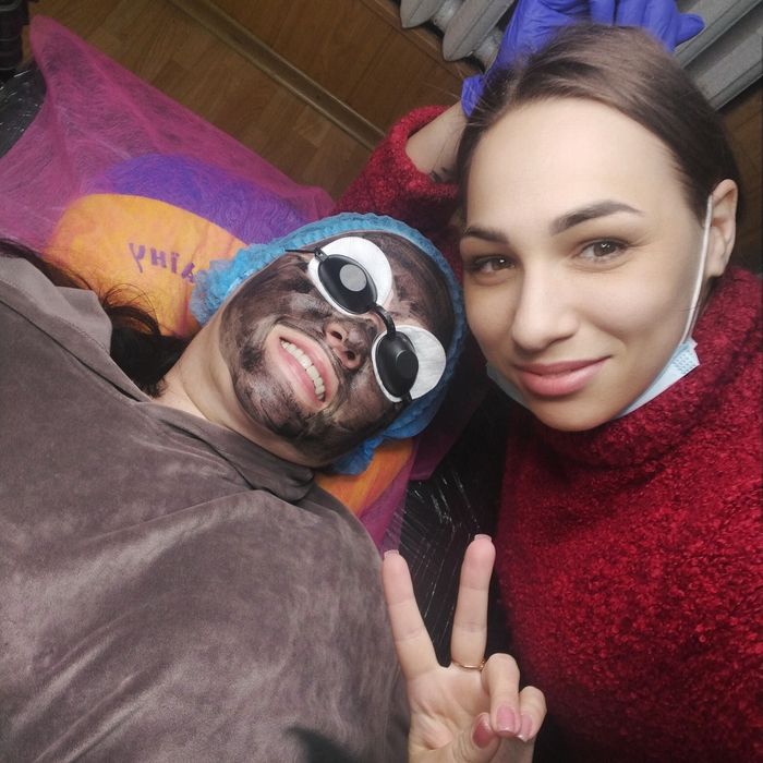 Карбоновий пілінг