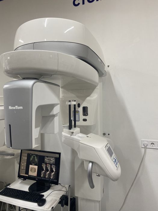 Компʼютерний томограф NewTom Giano