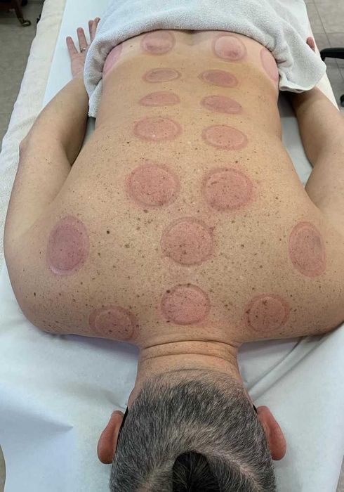 Massagista Terapias profissional