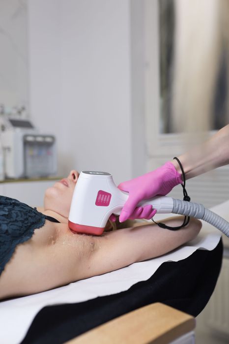 Wynajem Lasera do depilacji Medilase pro
