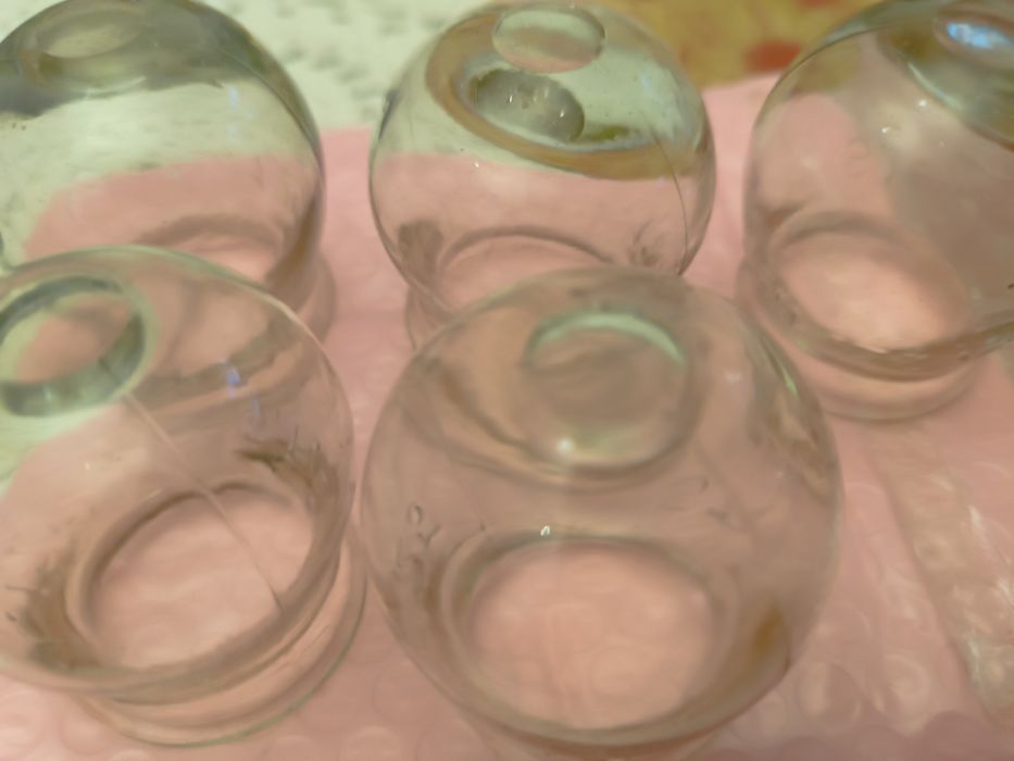 Bańki lekarskie ogniowe PRL "S.P.6 C.D. zł. 1,25"