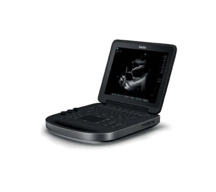 УЗД апарат SonoSite edge 2 ( 2022 ) ultrasound system