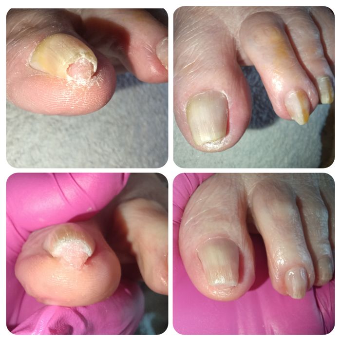 Pedicure medicinal ao domicílio