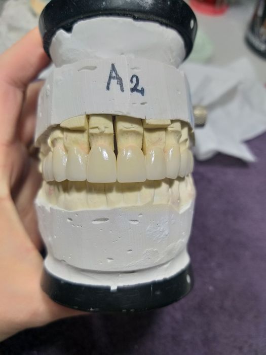 Зубний технік. Зуботехнічна Лабораторія  "Dental LAB"
