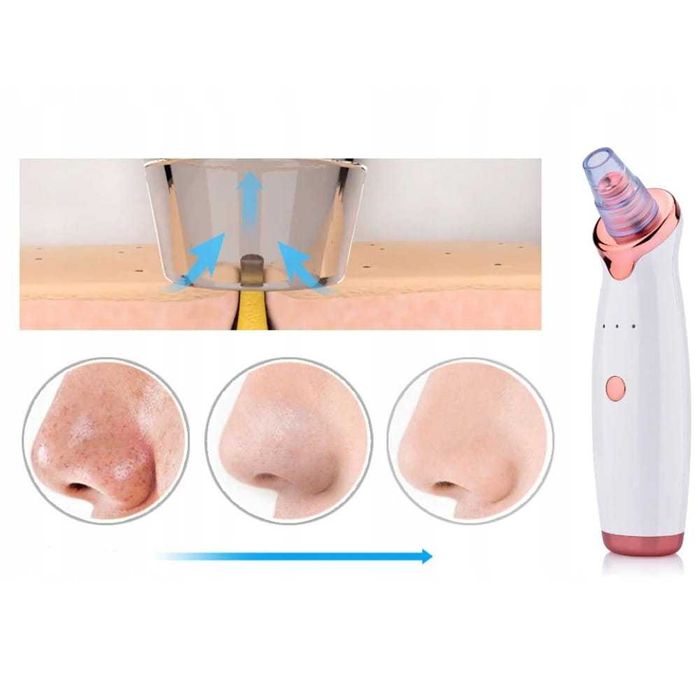 Urządzenie do oczyszczania twarzy odkurzacz do wągrów Powystawowy