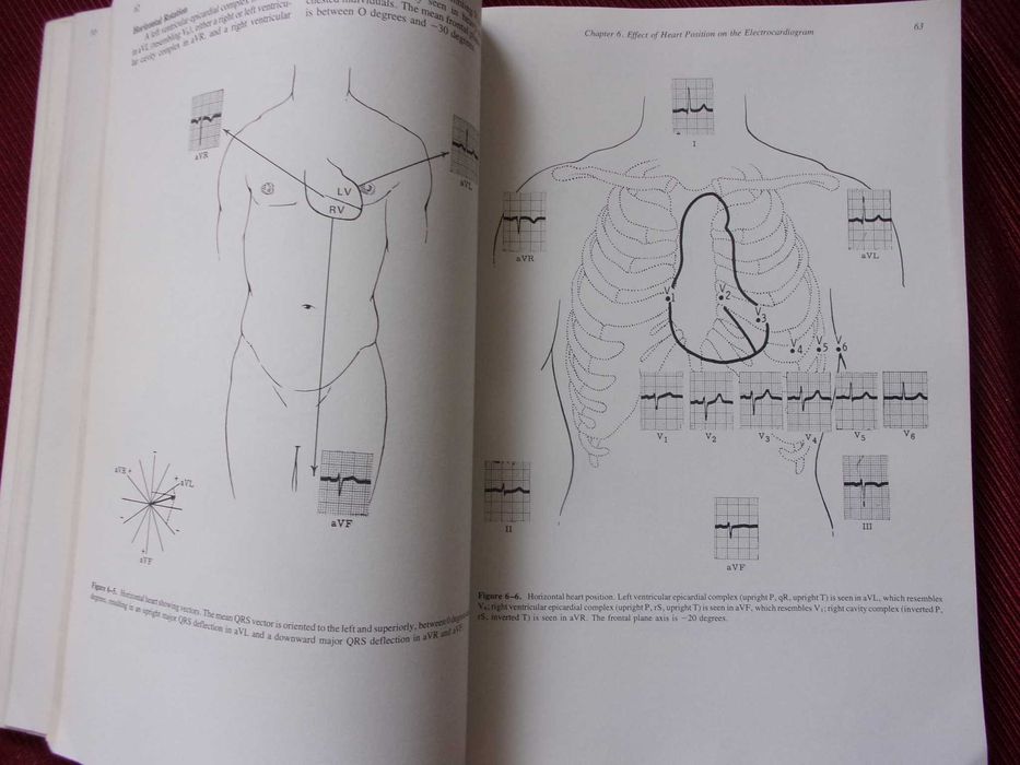 Principles of cliniical electrocadiography - wydanie 10 super stan