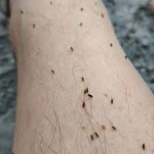 Уничтожение тараканов клопов блох ос шершн муравьев Знищення тарганів