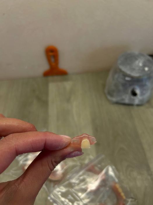 Пресовка інжекція нейлонових