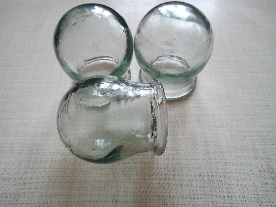 Банки медичні для мануальних процедур