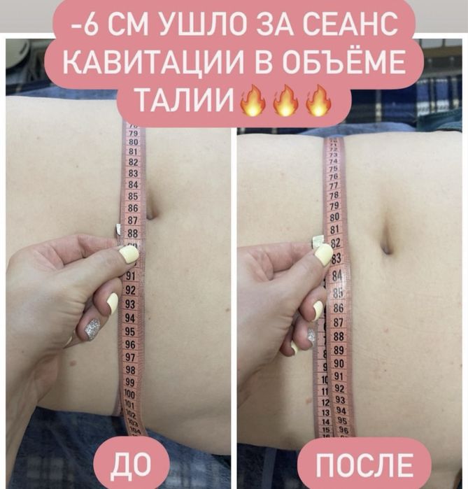 Массаж эпиляция. Только для женщин. Улица Степана Тільгы 34 А