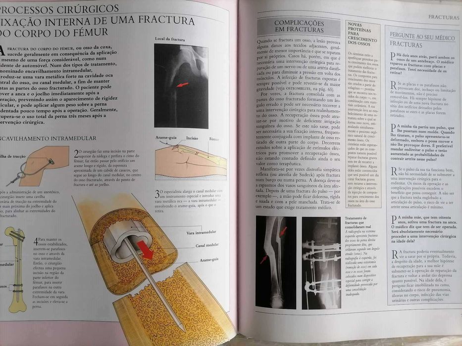 Livro Ossos , Musculos e Articulações