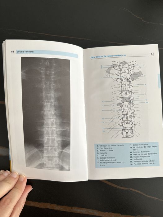 Atlas de Anatomia Radiológica