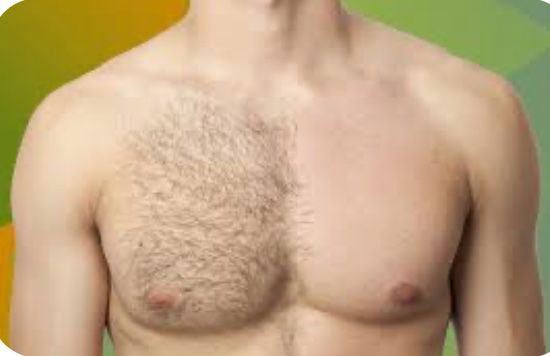 Депиляция мужская и женская