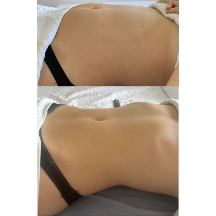 Massagem Profissional ao Domicílio | Resultados desde a 1ª sessão