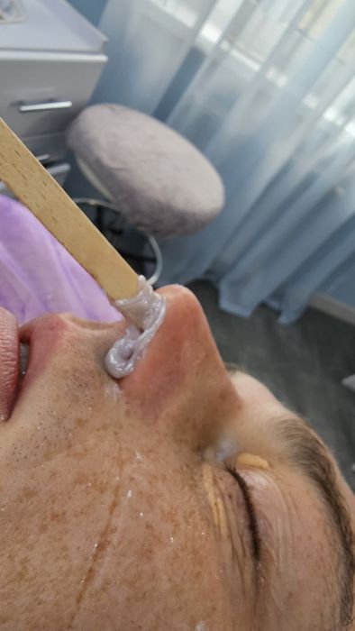 Депіляція воскова, парафінотерапія, чистка врослого волосся