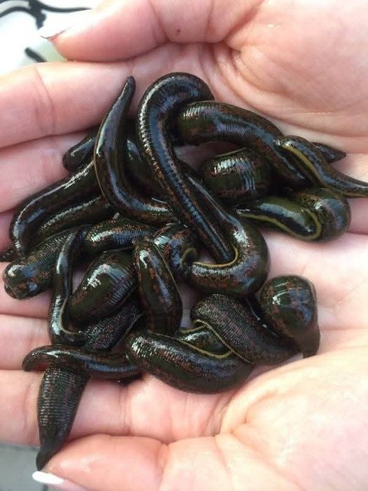 Гірудотерапія та мануальна терапія