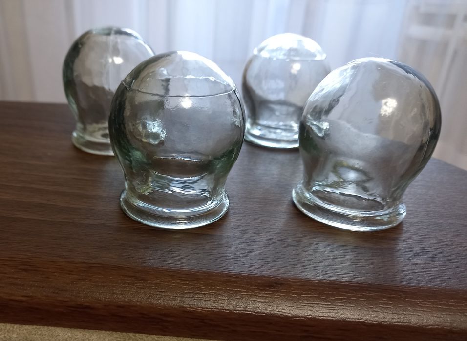 Банки лікувальні