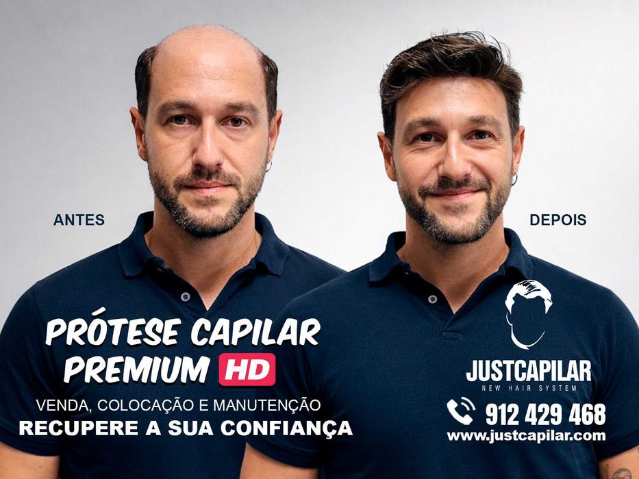 Prótese Capilar com Colocação e Corte, efeito real e imediato, em 2 horas volte a sorrir!