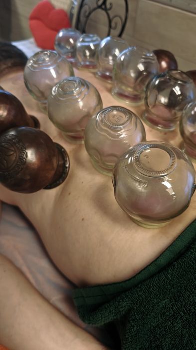 Stawianie baniek lekarskich, bańki – odporność, zdrowie, ulga w bólu