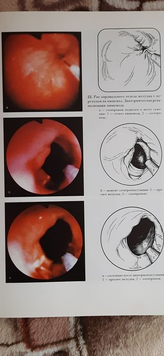 Атлас онкологічних операцій