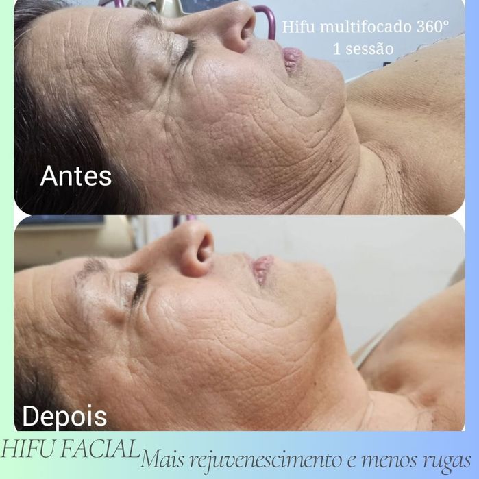Massagem Terapêutica  e Estética avançada