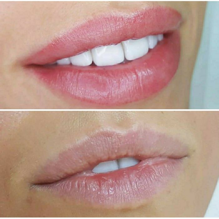 2000 грн будьяка зона!