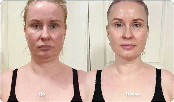 косметична хіджама