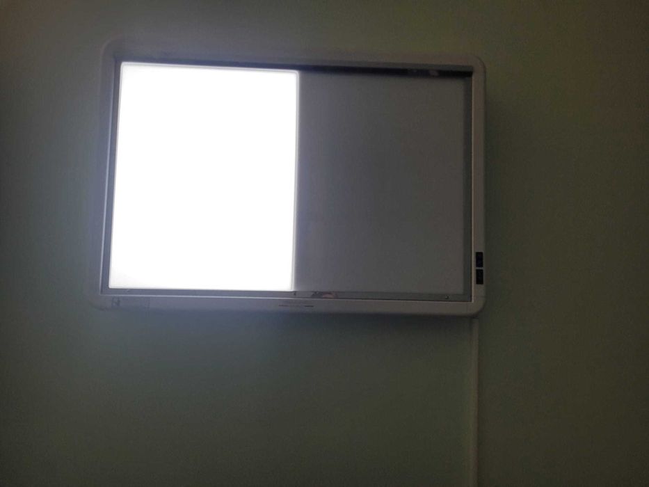 Negatoscópio 2 corpos, em chapa de aço inoxidável - NOVO