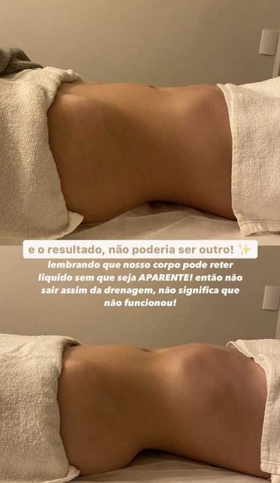 Drenagem Linfática facial e corporal