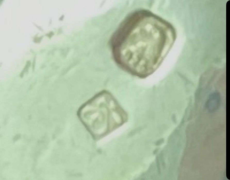 Anel em prata genuína e madrepérola.