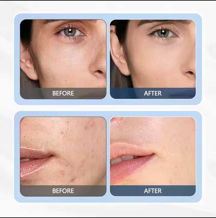 Лифтинг апарат для підтяжки,омолодження обличчя,відбілювання, очищення