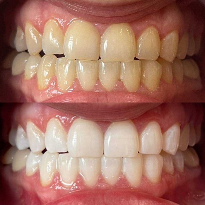 Косметична франшиза/Студія відбілювання зубів Smile LAB