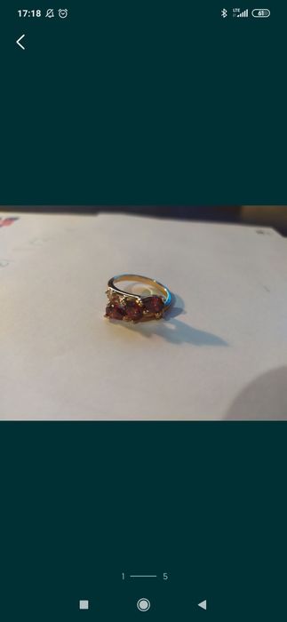 Pierścionek stal chirurgiczna