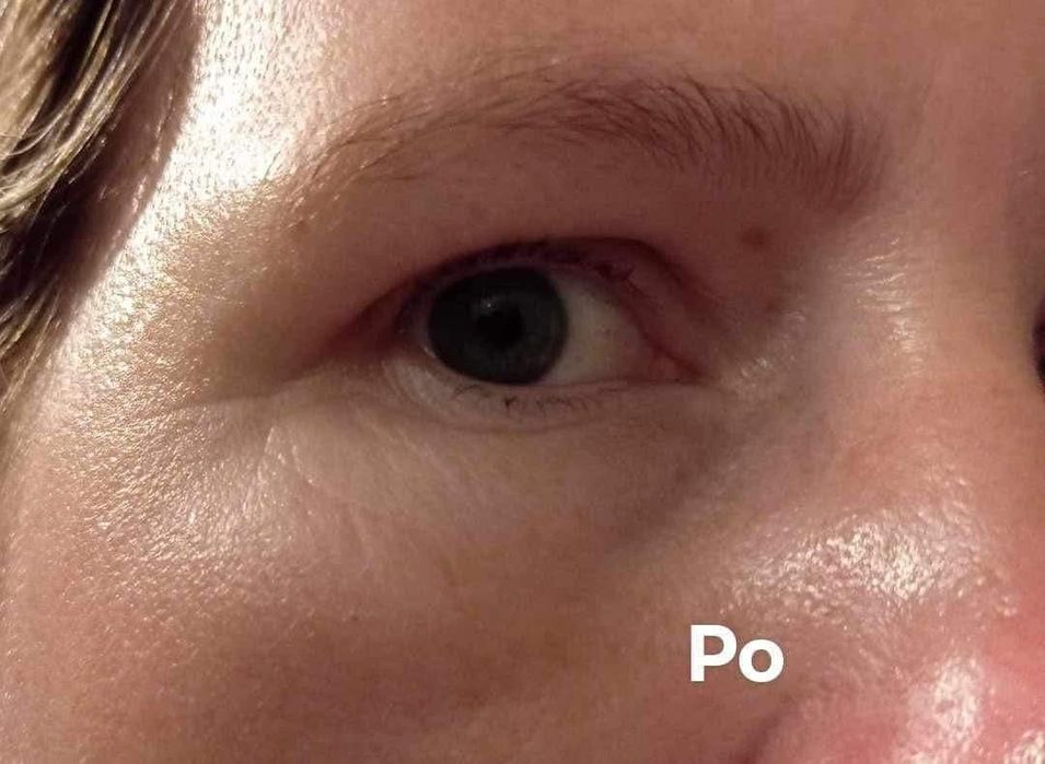 Hyaluron Pro. Ultranawilżające serum