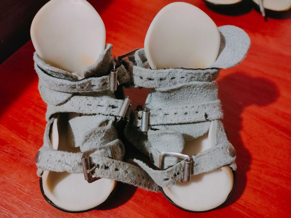 Брейсы "Митчелл"