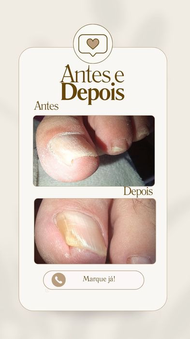 Pedicure medicinal ao domicílio