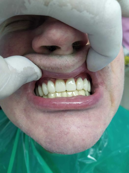 Стоматология. Протезирование .Имплантолгия