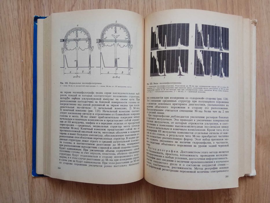 Михеев В.В., Мельничук П.В Нервные болезни 1981 год
