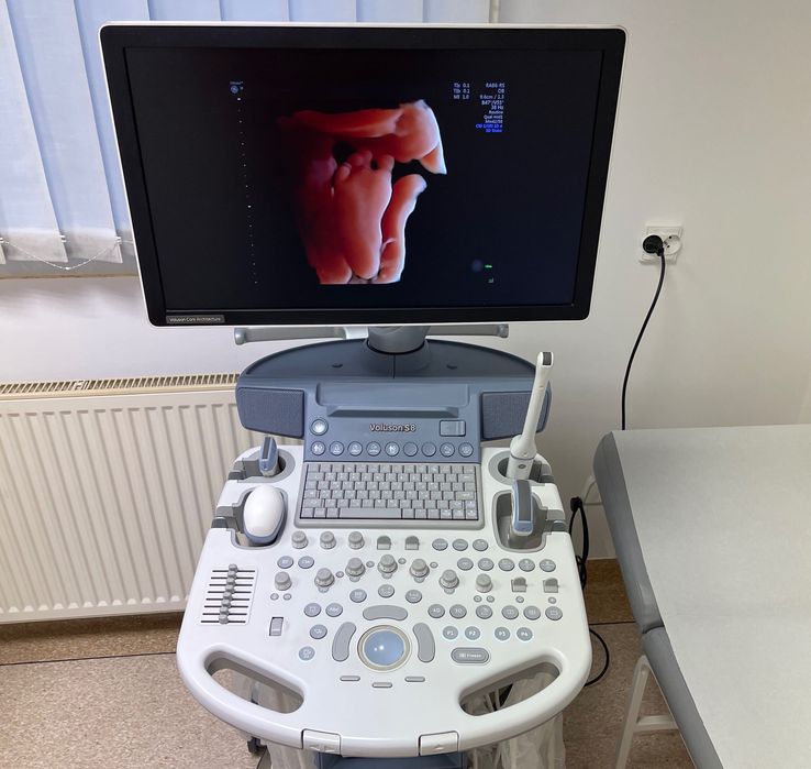 USG GE Voluson S8 BT16