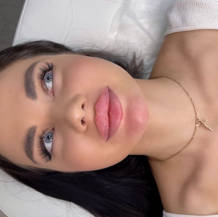 Powiekszanie ust PROMOCJA !!! Botox 200 zl
