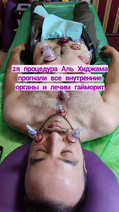 Обучение Хиджаме Харьков индивидуально и группой,  лично и онлайн