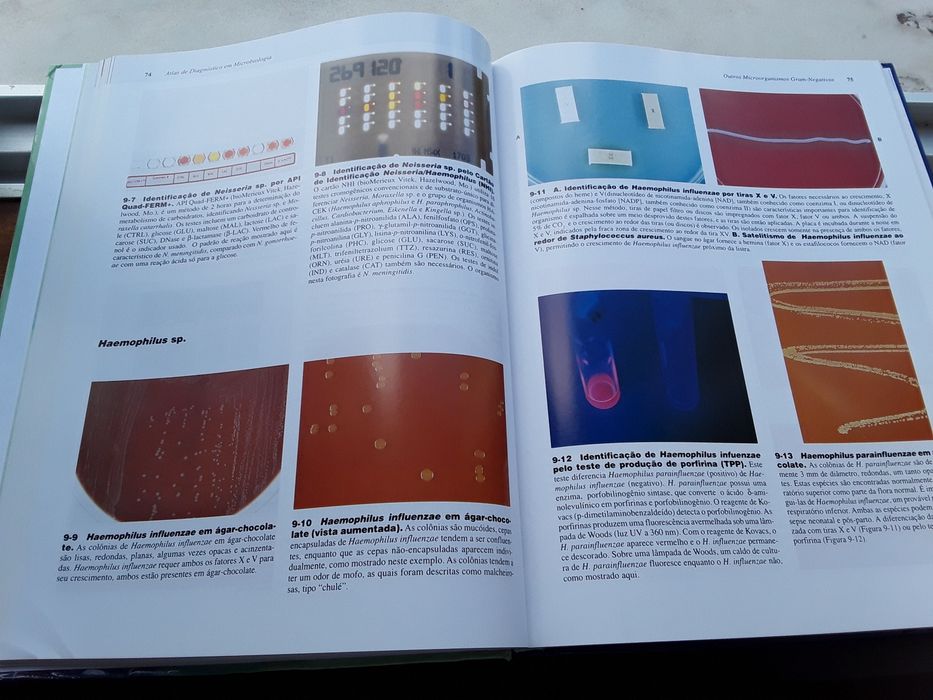 Vendo Atlas de Microbiologia Clínica. Novo.