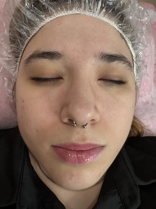 Epilação à linha ao domicilio